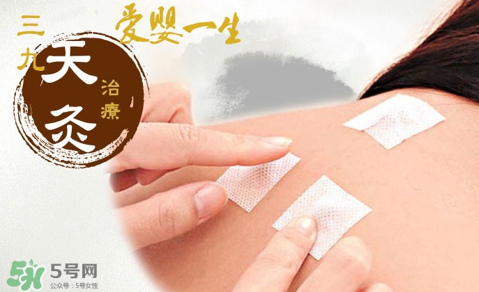 貼三伏貼掛什么科？三伏貼掛什么號(hào)？