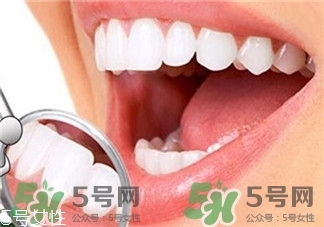 冷光美牙是什么?冷光美牙的特點(diǎn) 冷光美牙是什么?冷光美牙的特點(diǎn)