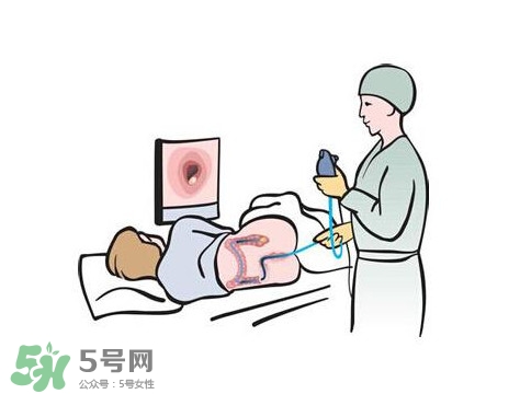 直腸癌怎么查出來的？直腸癌怎么判斷早晚期