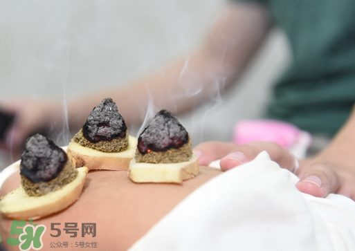 三伏灸什么人不能做？三伏灸適合哪些人？