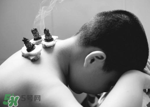 三伏灸什么人不能做？三伏灸適合哪些人？