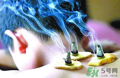 三伏灸什么時候開始灸？三伏灸怎么灸？