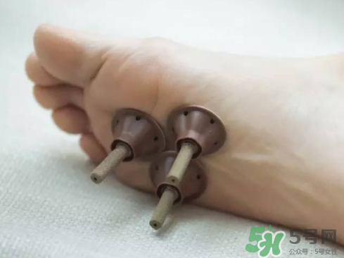 艾艾貼灸出水珠為什么？艾艾貼后有水珠要擦嗎？