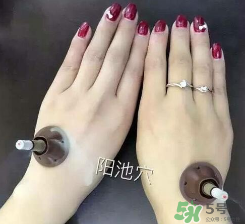 艾艾貼灸出水珠為什么？艾艾貼后有水珠要擦嗎？