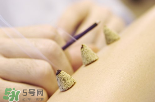 ?三伏灸和艾灸的區(qū)別_三伏灸是艾灸嗎 ?三伏灸和艾灸的區(qū)別_三伏灸是艾灸嗎