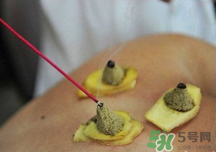 三伏灸可以自己灸嗎？三伏灸可以在家做嗎？