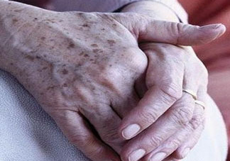 老年斑多大年齡開始有？為什么牙膏能去老年斑？