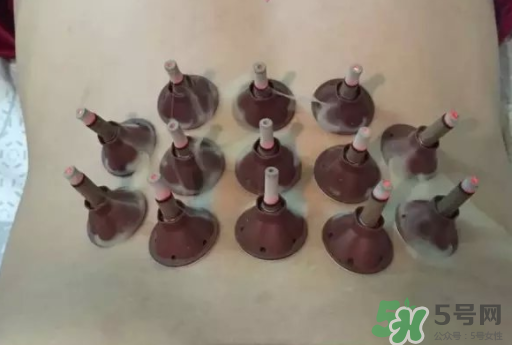 艾艾貼可以貼肚臍眼嗎？艾艾貼貼肚臍有什么作用？