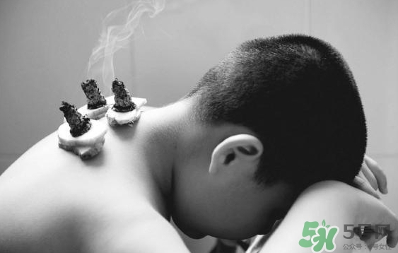 三伏灸要灸幾次？三伏灸要灸多久？