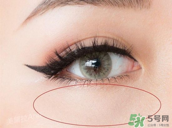 玻尿酸填充淚溝多久恢復(fù)自然？玻尿酸填充淚溝的危害