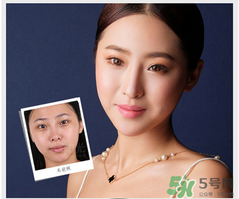 填充淚溝有風險嗎？填充淚溝的方法