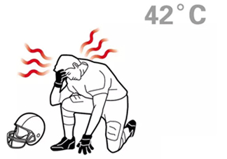 熱射病為什么不能喝水？熱射病為什么會抽搐