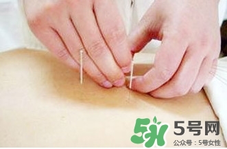 什么人不能做放血療法？放血療法有什么功效？