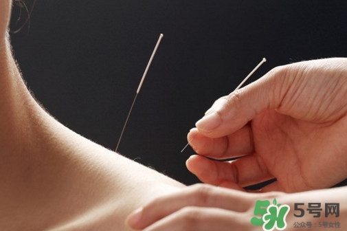 針灸能治療哪些??？古代針灸用具是幾針