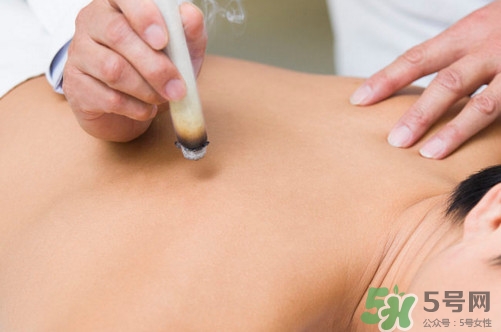 三伏灸一次做多長時間？三伏灸用新生姜好還是老的好