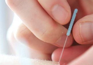 什么是放血療法？放血療法能治什么病