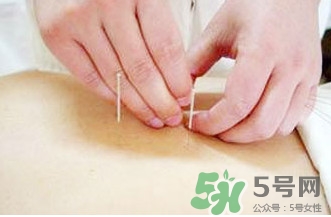 放血療法治中風(fēng)靠譜嗎？放血療法主要針對(duì)什么樣的病