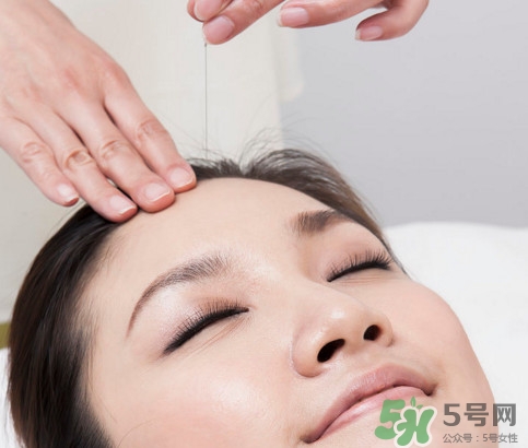 針灸到底疼不疼??？針灸最適合哪些病