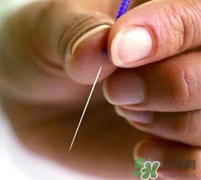 放血療法能治濕氣重嗎？放血療法治病的原理是什么