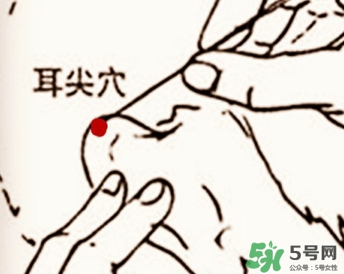 什么人不能做放血療法？放血療法有什么功效？