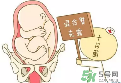 胎位不正能順產(chǎn)嗎？胎位不正怎么辦？