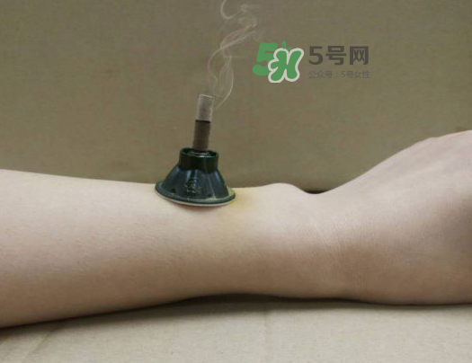 三伏天下雨可以艾灸嗎？三伏天下雨艾灸好嗎？