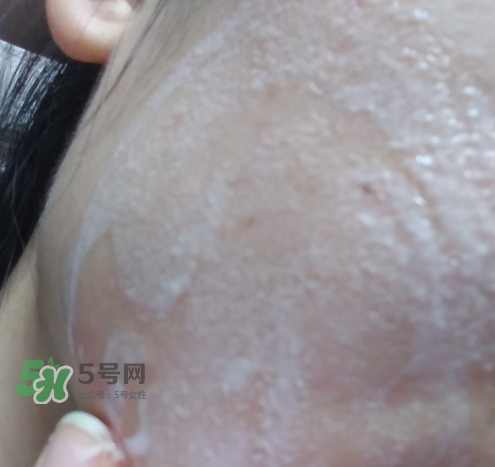 貝蜜清凈痘控油潔面啫喱怎么樣？貝蜜清祛痘控油潔面啫喱好用嗎？