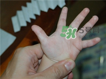 汗皰疹是什么?汗皰疹的治療 汗皰疹是什么?汗皰疹的治療