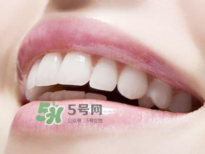 烤瓷牙的壽命是幾年?烤瓷牙的壽命影響 烤瓷牙的壽命是幾年?烤瓷牙的壽命影響