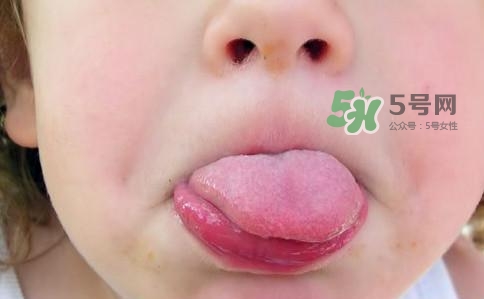 三伏天為什么濕氣重？三伏天為什么要注意祛濕？