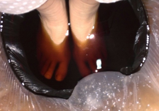 醋泡腳用白醋還是陳醋？泡腳用什么醋最好？