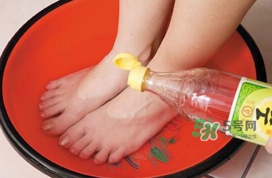 醋泡腳用白醋還是陳醋？泡腳用什么醋最好？