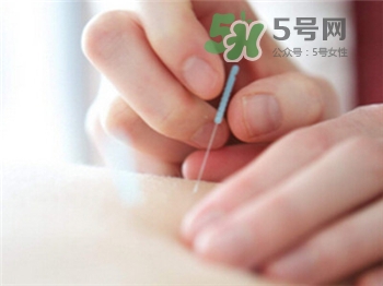 針灸減肥的誤區(qū) 針灸減肥注意事項(xiàng) 針灸減肥的誤區(qū) 針灸減肥注意事項(xiàng)