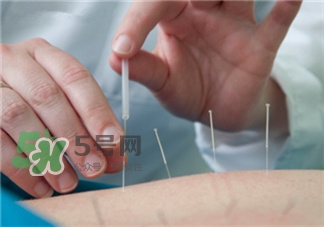 針灸減肥的誤區(qū) 針灸減肥注意事項(xiàng) 針灸減肥的誤區(qū) 針灸減肥注意事項(xiàng)