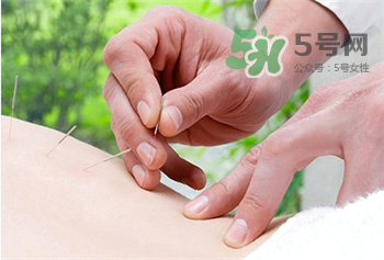 針灸減肥有效嗎?針灸減肥的好處 針灸減肥有效嗎?針灸減肥的好處