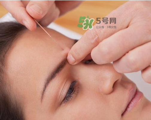 三伏天針灸有什么好處？三伏天針灸注意什么？