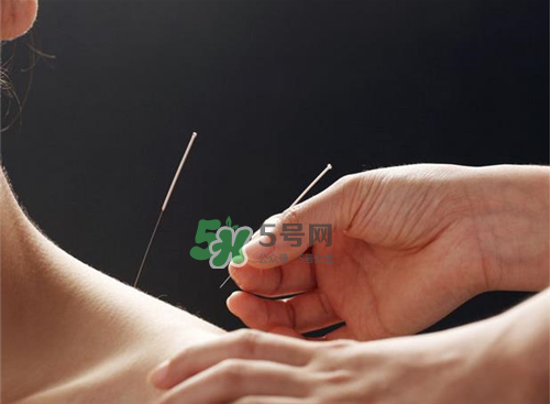 三伏天針灸有什么好處？三伏天針灸注意什么？