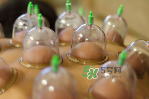 拔火罐是夏天好還是冬天好？什么時(shí)候拔火罐最合適？