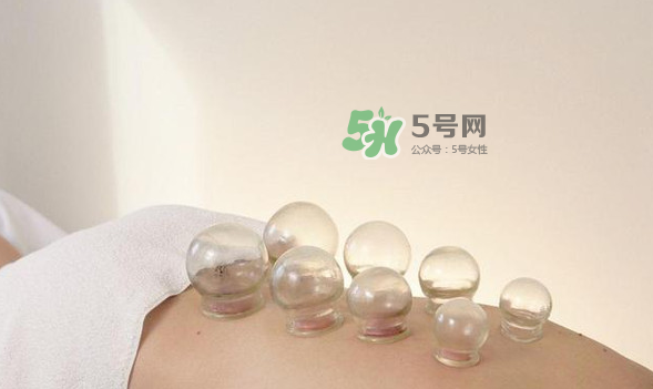 拔火罐是夏天好還是冬天好？什么時(shí)候拔火罐最合適？