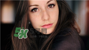 曬斑和雀斑是一樣的嗎?曬斑和雀斑的區(qū)別 曬斑和雀斑是一樣的嗎?曬斑和雀斑的區(qū)別