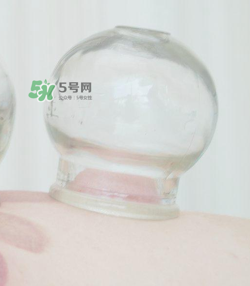 拔火罐一次多長(zhǎng)時(shí)間？拔火罐一般多長(zhǎng)時(shí)間？