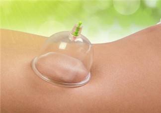 拔火罐是夏天好還是冬天好？什么時候拔火罐最合適？