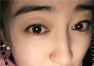 做美瞳線會(huì)不會(huì)掉睫毛？做美瞳線掉睫毛怎么辦？