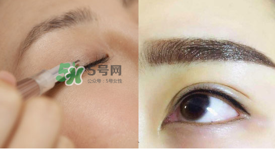 美瞳線有必要做嗎？做美瞳線多少錢(qián)？