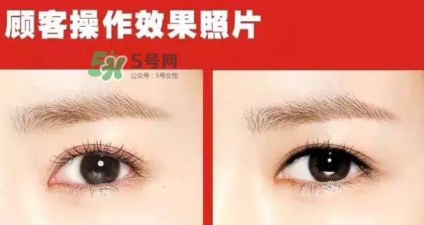 美瞳線有必要做嗎？做美瞳線多少錢(qián)？