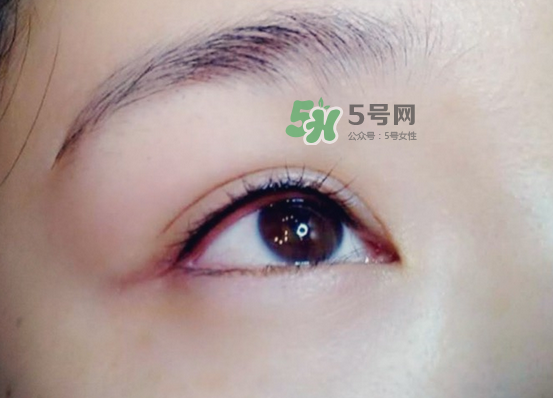 做美瞳線疼嗎？做美瞳線后要注意什么？