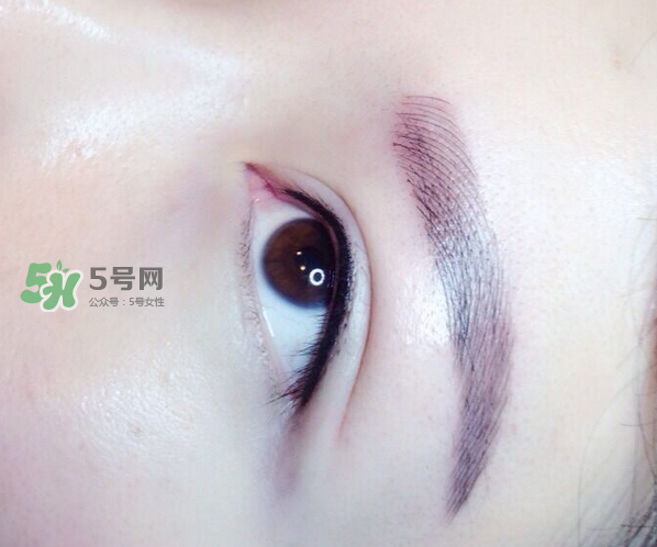 做美瞳線疼嗎？做美瞳線后要注意什么？