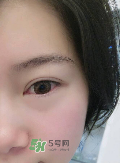 做美瞳線疼嗎？做美瞳線后要注意什么？