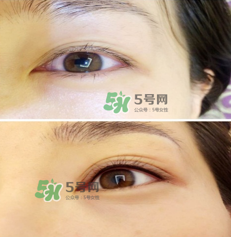 做美瞳線眼睛會(huì)腫嗎?做美瞳線眼睛腫了怎么辦? 做美瞳線眼睛會(huì)腫嗎?做美瞳線眼睛腫了怎么辦?