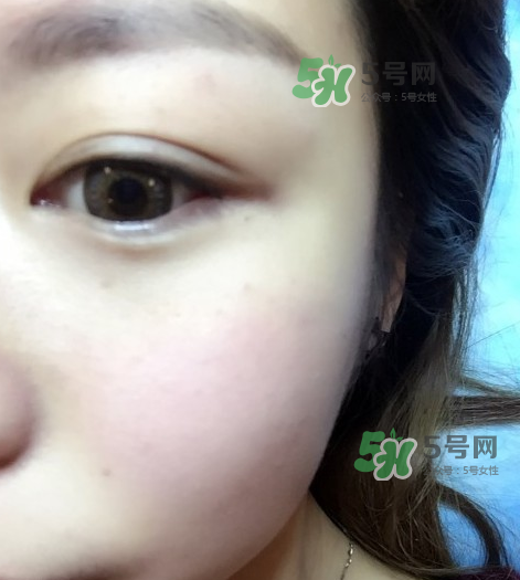 做美瞳線眼睛會(huì)腫嗎?做美瞳線眼睛腫了怎么辦? 做美瞳線眼睛會(huì)腫嗎?做美瞳線眼睛腫了怎么辦?